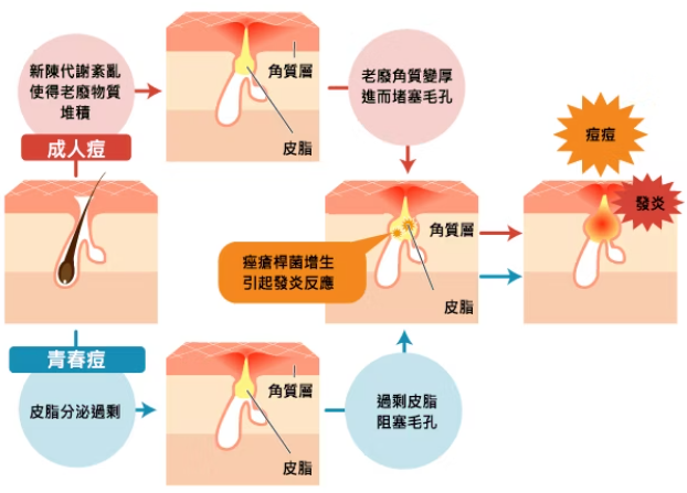 為什麼換季肌膚就不穩定